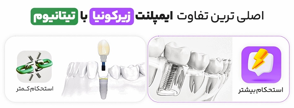 ایمپلنت ایمپلنت دندانی تیتانیومی