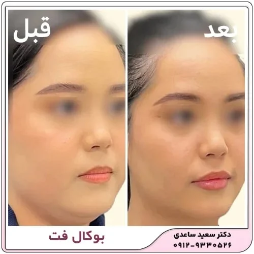 فواید بوکال فت