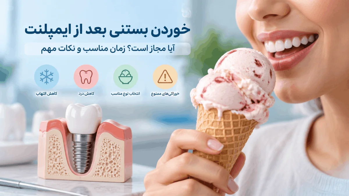 خوردن بستنی بعد از ایمپلنت؛ زمان مناسب، مزایا و نکات مهم